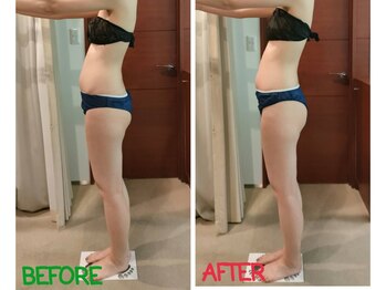 ビューティーエッセンス 都立大学(BEAUTY ESSENCE)/反り腰辛い