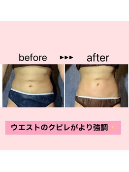 カナウ(kanau)/くびれ作りお任せください