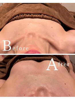 ロココ 水戸店(Rococo)/バストアップBefore After