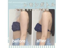 ハロ 南青山(HALO)の雰囲気（痛みが少なく効果のある機器のみを厳選☆1回目から確実に変化）