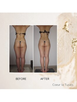 クーラ テュセ(Coeur la Tusais)/【40歳まで】全身まるごと痩身