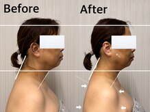 ベール(BEHL)/コルギのBefore After