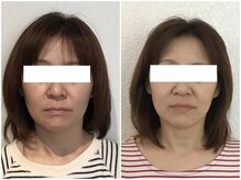 美容整体 ウェリナ 蟹江院/小顔矯正/骨盤矯正/美脚サロン 