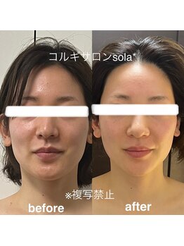 ソラ(sola*)/美人度爆上げ