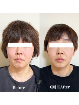 セレーノ(Sereno)/いつまでも若々しく