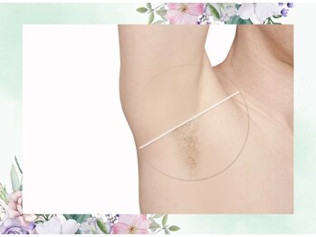 プルート(Pluto)/脱毛 Before / After