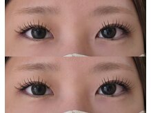 ネオリーブサイン(Neolive sign)/パリエク100本