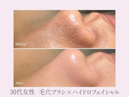 salon Uru.（サロン ウル）|毛穴・ニキビ・美肌専門の写真