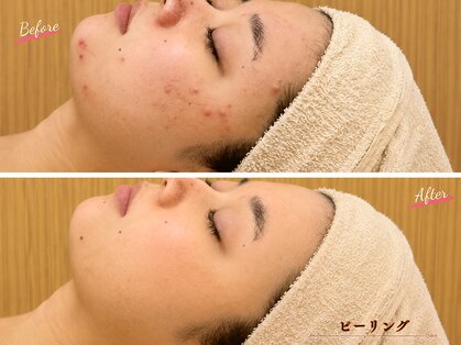 エピファニー(Epi phany Total Beauty Salon)の写真