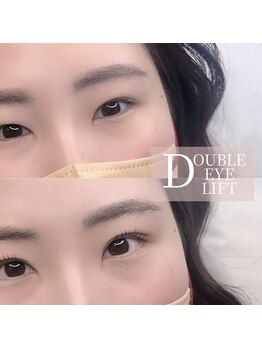 エールラッシュカール 森ノ宮(aile lash curl)/アイストレッチ