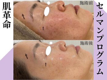 ラヴィニティ 池袋(Lavinity)/セルマン