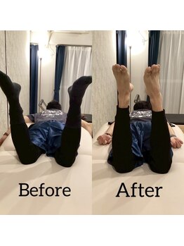 おこしんちゅ 渋谷 代々木公園/股関節の可動域改善！