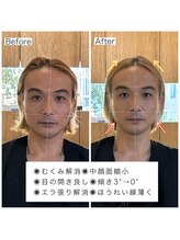 シャウルデッサン(CHARLESDESSIN)/骨格補正スパ/首肩矯正