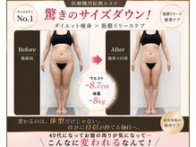 ラヴィアンローズ 岐阜本店(La vie en Rose)の雰囲気（キャビテーション施術3ヶ月《上半身/二の腕/足/背中》）