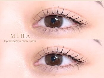 ミラ 柏(MIRA)の写真/モチの良さが最大の魅力☆目元・お顔の悩みはMIRAにおまかせ♪丁寧なカウンセリングで理想のデザインに◎