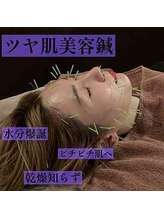 ルディア 堂島店(ledia)/美容鍼にお任せ！アナタの美肌