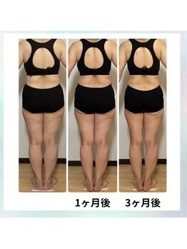 さいわい整骨院/痩身筋膜リリースでの変化