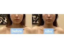 アジール 長岡リバーサイド千秋店(agir)/before/after画像