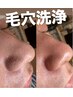 【毛穴洗浄で毛穴スッキリ】ハイドラフェイシャル×小顔エステ120分¥15000