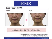 ラヴィニティ 池袋(Lavinity)/EMS