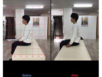 ストレチックス 近江八幡店/BeforeAfter