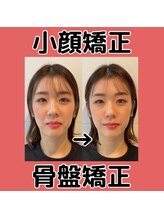 ビーバランス 本町店(美-Balance) 小顔 矯正