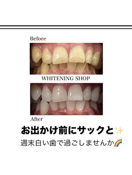 ホワイトニングショップ 緑橋店/フィルターいらずの白い歯に！