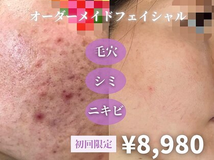スパ ザ トルトル(SPA The toltol)の写真