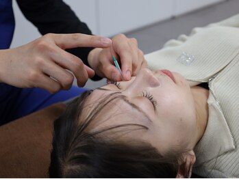 小林整骨院 池田の写真/【オーダーメイド美容鍼】素肌から輝く、自分史上最高の美しさへ