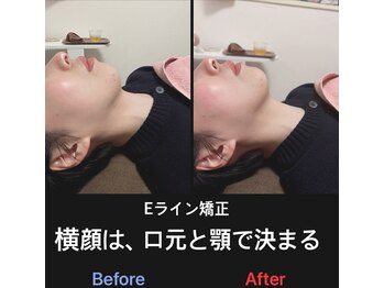 美容矯正サロン レレポノ(LELEPONO)/