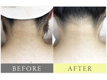 都度払いサロン Clear＋ 泡瀬店【クリアプラス】脱毛/フェイシャル/痩身/バストケア/美肌全身脱毛