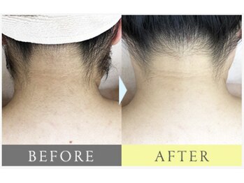 都度払いサロン Clear+ 泡瀬店【クリアプラス】脱毛/フェイシャル/痩身/バストケア/美肌全身脱毛