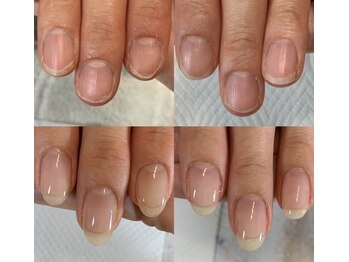 ロイヤル ネイルサロン(Royal nail Saloon)/ピンクを縦長にする自爪育成