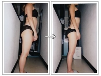 ルッチョラ(Lucciola)/ビフォーアフター