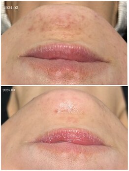 ヒルナム(Heal Nam)/~プロセルセラピーズ~フェイス