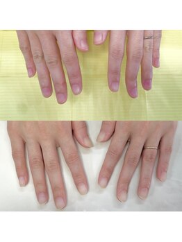 ハッカネイル(HAKKA NAIL)/
