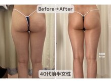 ピーチ(Peach)/骨盤矯正×痩身×リンパ エステ