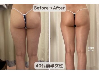 ピーチ(Peach)/骨盤矯正×痩身×リンパ エステ