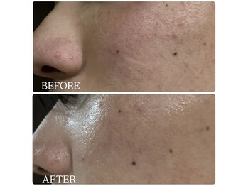 カピリナ(ka pilina)/お家でエステ★セルフゴマージュ