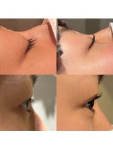 ルッカ(Lukka)/まつげパーマ・ラッシュリフト