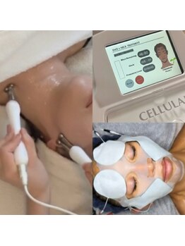 ホウレイ線・たるみ改善！予防ケア