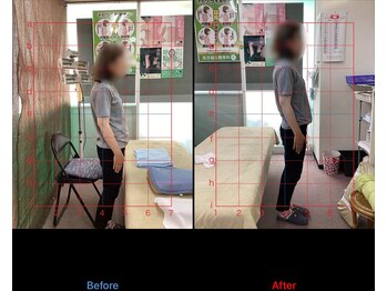 高芝鍼灸整骨院/姿勢矯正