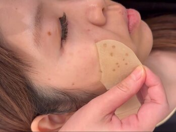 ヘルバ(HERBA)の写真/【最新シミケアWHITELAB☆導入】お肌に働きかけ根本から改善！自分史上最高なスッピン美肌☆