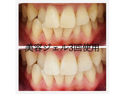 シエル(CIEL)の写真