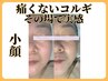 むくみ顔・スッキリ解決！　小顔コルギ！