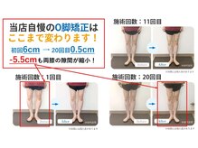 むね整体院 カナザワ(KANAZAWA)の雰囲気（当店自慢のO脚矯正はここまで変わります!）