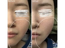 アイビューティー(Eye Beauty)/韓国肌管理