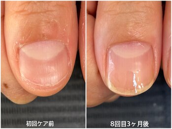 エムズ(m's)/【自爪育成】３ヶ月コース