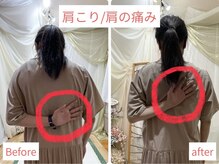 活法術 福岡整体院/肩の痛み、手が後ろに回らない