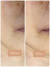 FJ/乾燥からの小ジワ改善